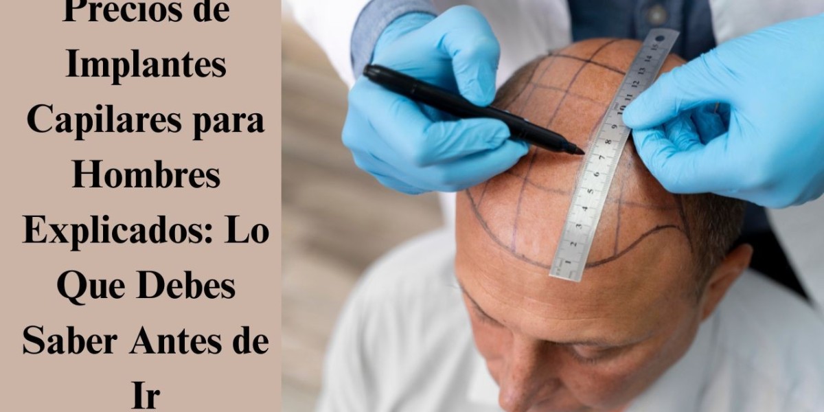 Precios de Implantes Capilares para Hombres Explicados: Lo Que Debes Saber Antes de Ir